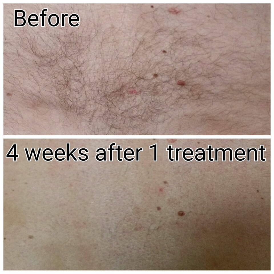 beforeandafterhair beforeandafterhair